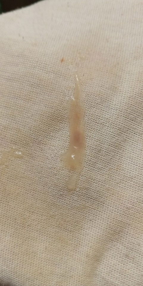 Mucus plug naba ito??