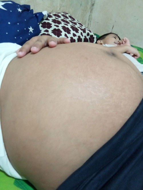37weeks&3days 
EDD:sep/15/2025