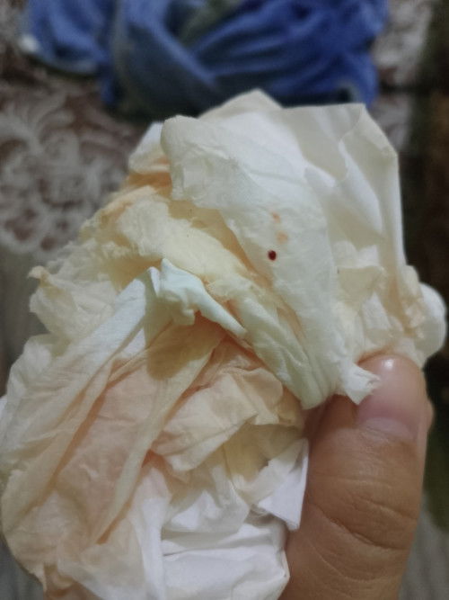 Bangun tidur keluar cairan warna pink