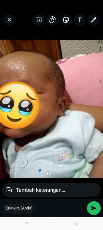 Kulit anak bruntusan