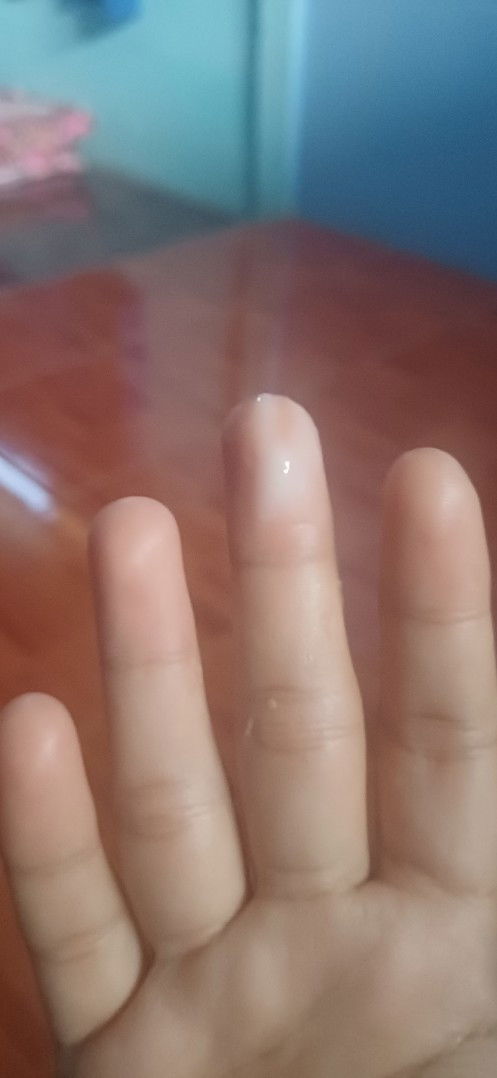 มูกหรือตกขาว