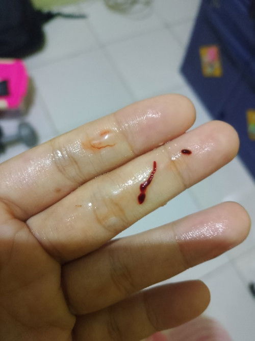 Hamil 38w keluar cairan pink