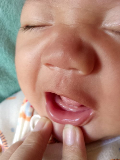 ลูก2เดือน13วันฟันขึ้นเเปลกไหคะ