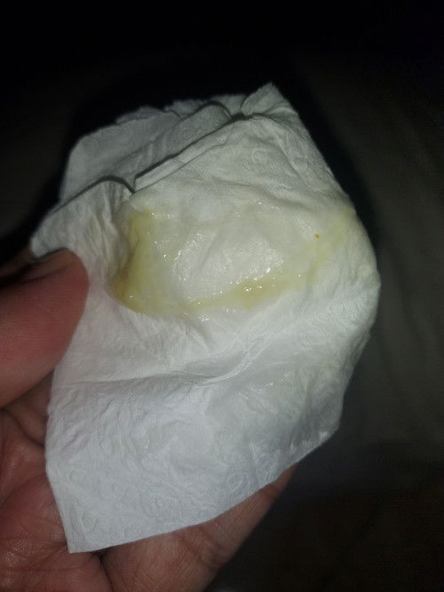 GBS atau CANDIDA