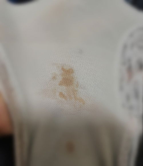 Assalamualaikum..sya nk tnya, normal ka 8mnggu ada kuar mcm ni..risau pulak.2hri lpas dh scan,ok je.