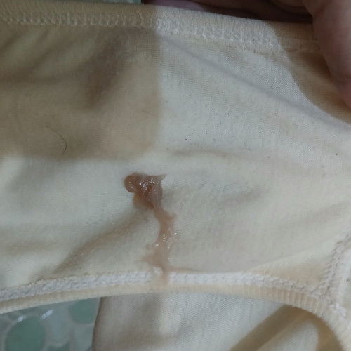 noda lendir kental di cd