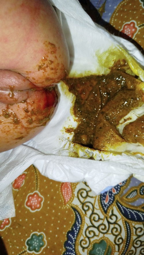 Pup keluar lendir darah