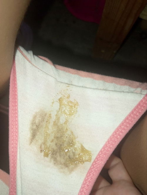 Help po discharge galing sa 5y.old