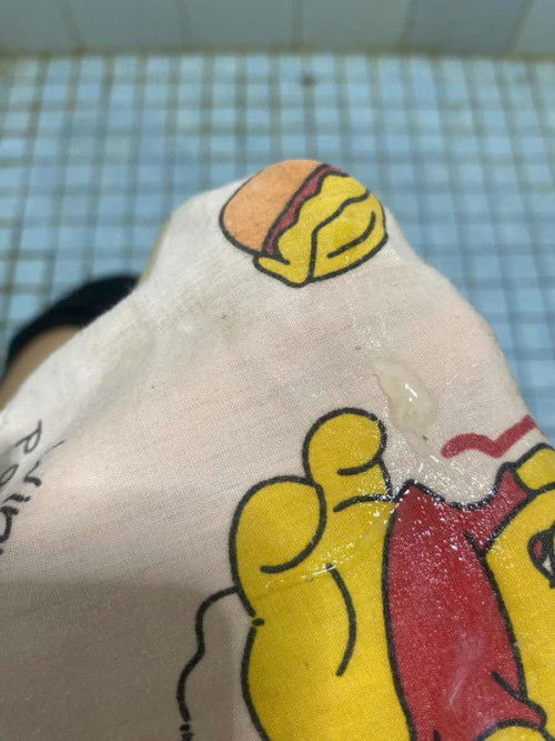 อายุครรภ์40+6