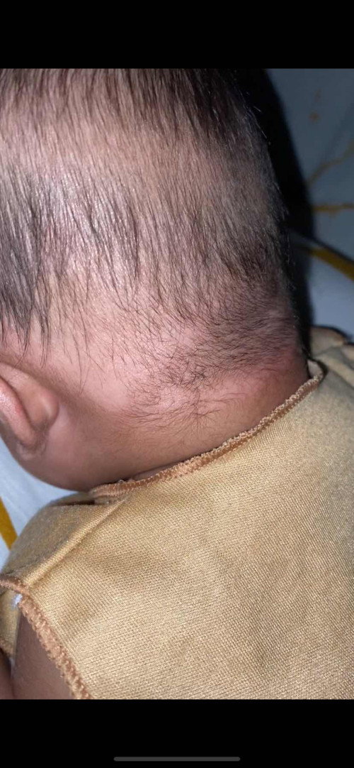 Bercak putih di pipi dan dibelakang kepala