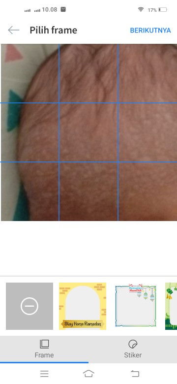 Assalamualaikum bunda2, ada yg pernah bayinya mengalami sprti yg di foto kah bund?