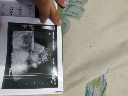 USG 7 week tapi masih kelihatan kantongnya aja tidak ada djj..apakah itu aman Bun ?