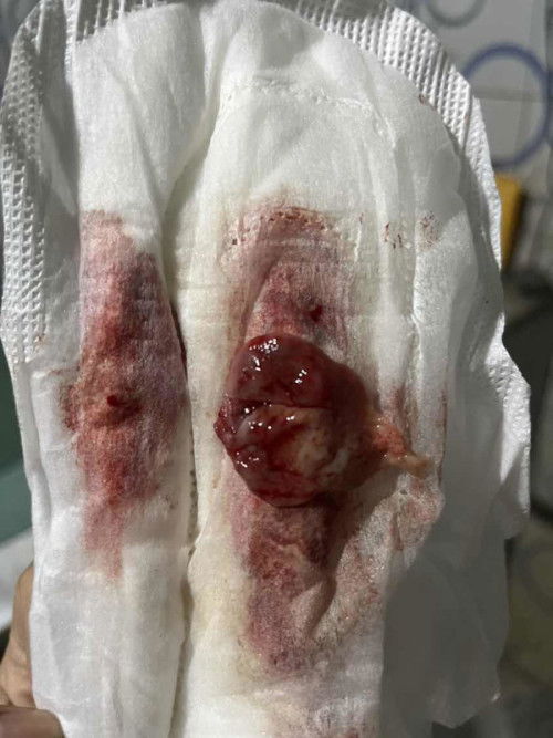 Keluar darah setelah 3 bulan melahirkan