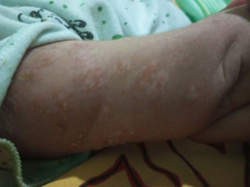 Minta saran dong mam buat sikecil