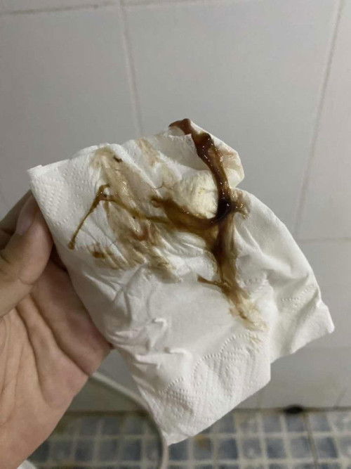 40+2มีมูกแบบนี้มาหาหมอแต่ปากมดลูกเปิด1เซนไม่มีอาการปวดเลยอีกนานไหมคะกว่าจะปวดท้องคลอด เป็นตั่งแต่เมื่อวานตอน6โมง