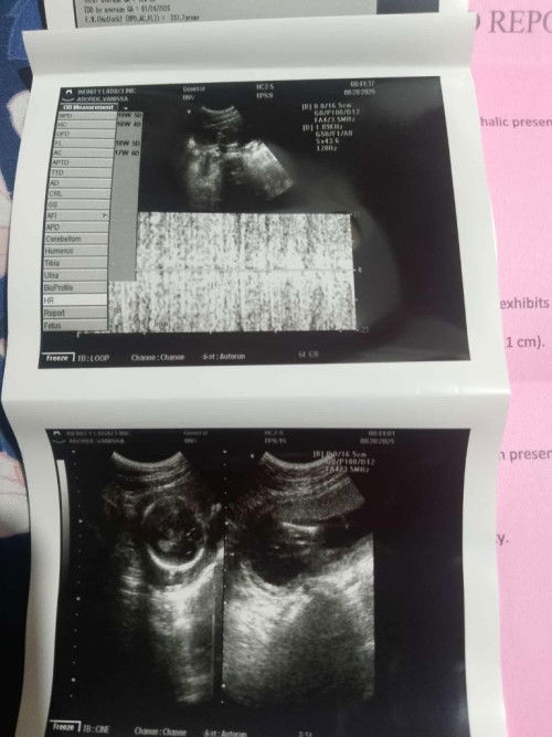 Ano pong ibig sabihin ng result ko thankyou po