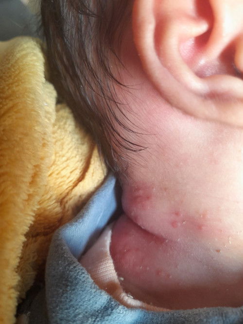 Kulit bayi sensitif