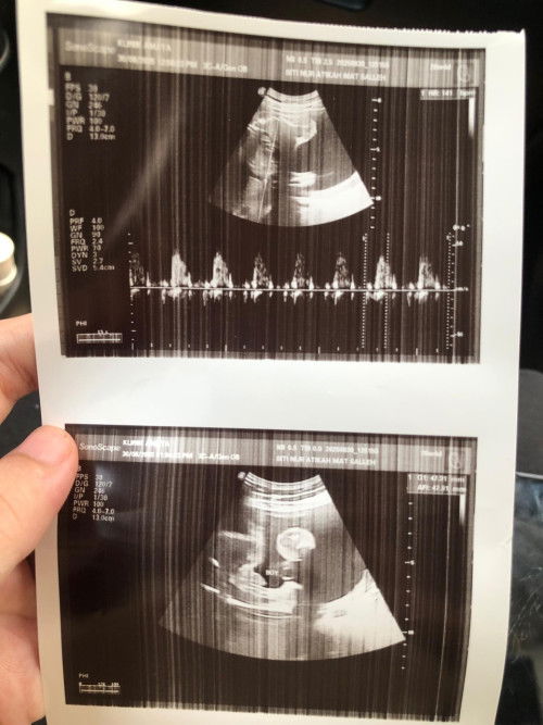 Scan 26week