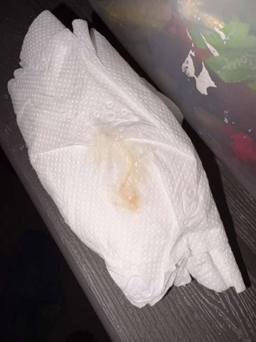 spotting or period discharge?