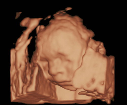 Kabado pero Excited 🥺
Now @ 25 weeks! May we all have a safe and normal delivery.