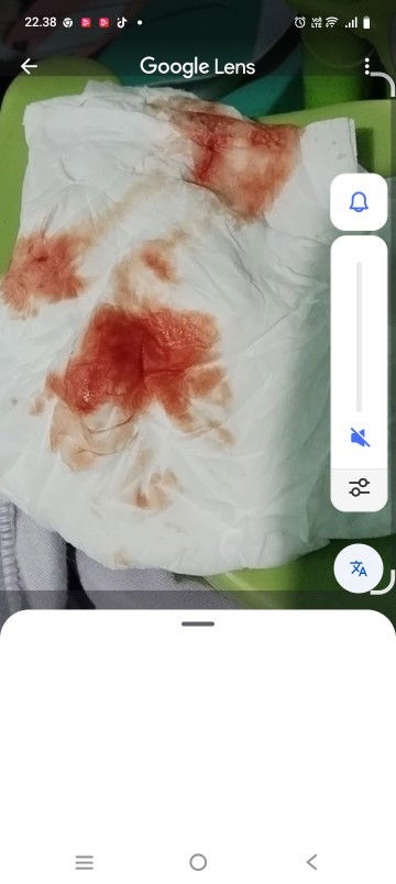 Slmat malam maaf mau taya klau keluar flek kaya ini tanda apa ya...