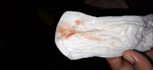 แบบนี้คือมีมูกเลือดแล้วใช่ไหมค่ะ