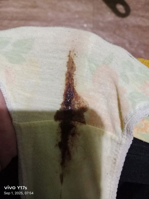 35 weeks pero may discharge na ganito ano po kaya to