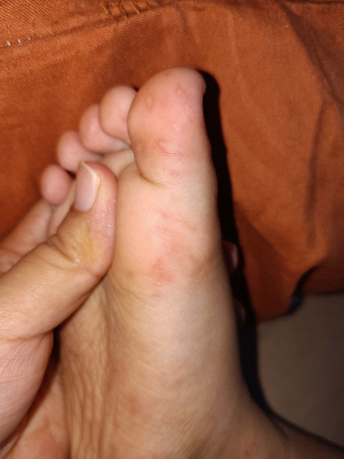 Ada yang tahu ga bund.
Ini termasuk sakit apa ya?