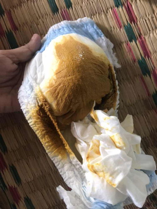 นมแม่ล้วนแต่อึเปลี่ยน