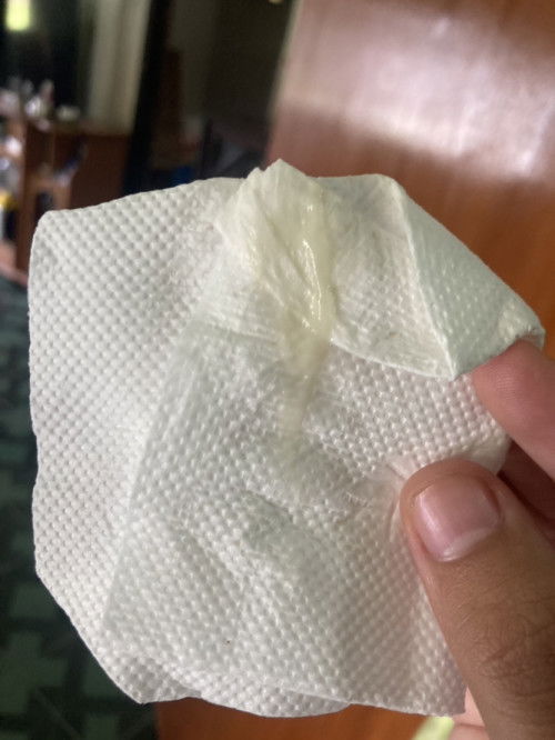 แบบนี้คือมูกหรือตกขาวคะ ตั้งครรภ์32week