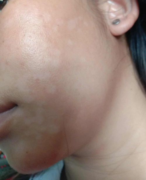 ขอคำแนะนำคำปรึกษา