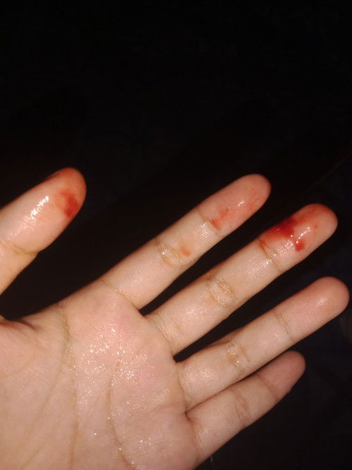Assalamu'alaikum Bunda
Saya hamil 6 minggu ko keluar darah ya bun ada yang pernah ngerasain