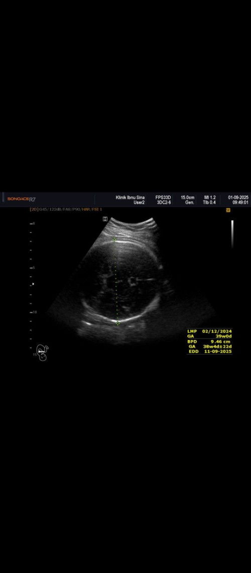 haii momm mau tnya,bntu jwb ya