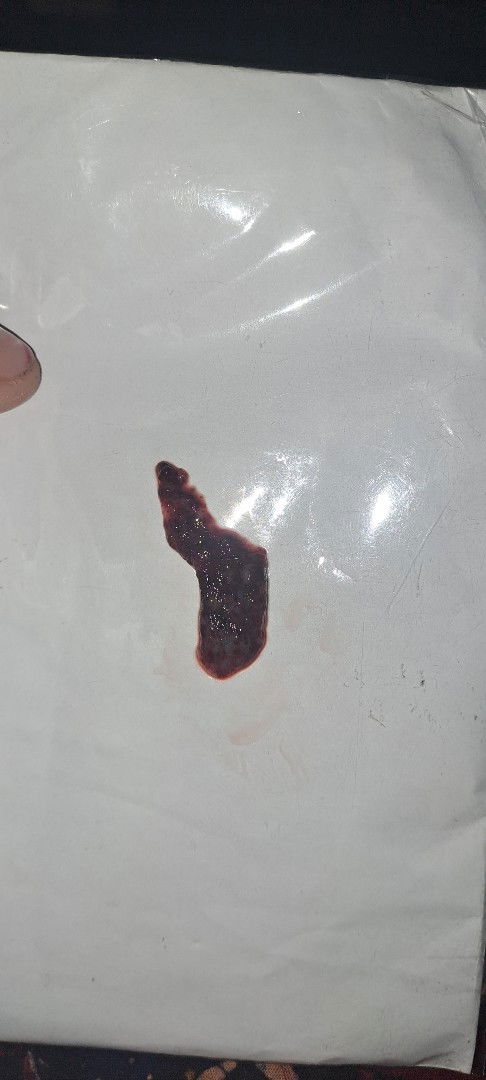 hay moms. saran donk saya hamil 6 week kluar darah