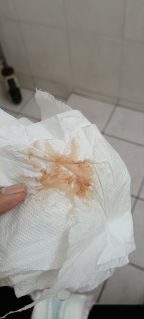 Siapa pernah situasi begini, adakah ni tanda2 miscarriage