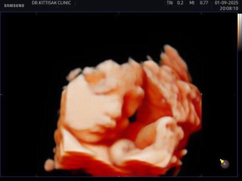 สรุปแล้ว หนูเป็นผู้หญิงค่า🥰