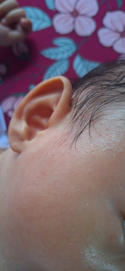 Rekomendasi face cream