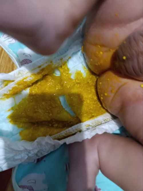 Poop ni Baby, 2 months old BF