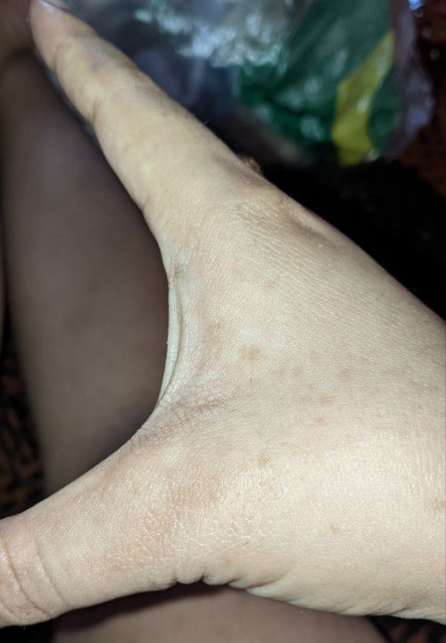 ada yg sama ga bundd