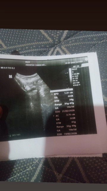 Usg uda dua kali yang ketiga beda tmpt krna di tmpt biasa lg tutup ,lg diluar mknya rencana
