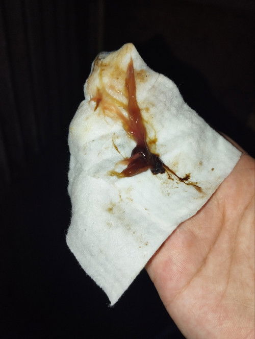 Mucus plug naba ito?