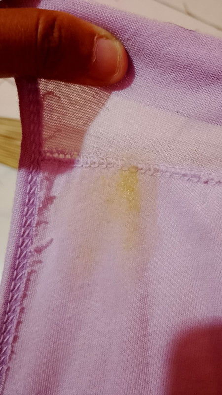 Mom aku hamil 11 Minggu, keluar Kya keputihanya kuning gth, tapi saat keluar seperti orang mens