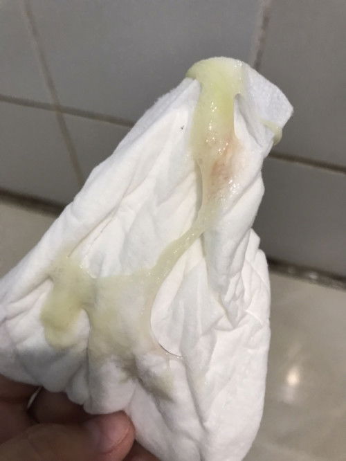 Mucos plug