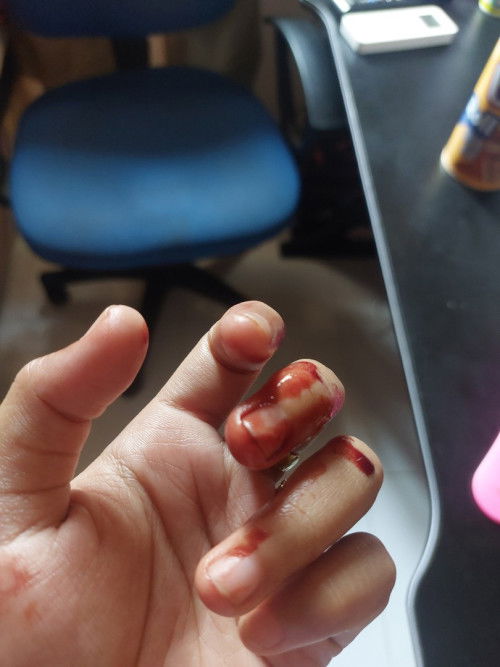 Hari ini saya pendarahan di kehamilan 9 week, supaya janin kuat sampai persalinan bagaimana?