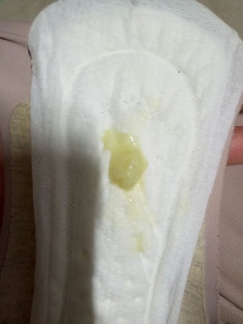Keluar lendir