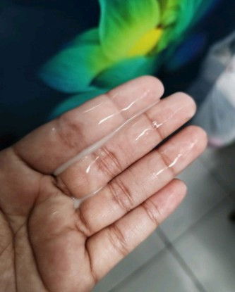 Keputihan atau ketuban???