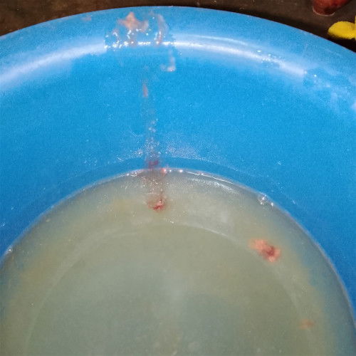 Hello po, may discharge napo ako pero di pa sya sumasakit. Sorry po sa pic. Bat kaya di nasakit.