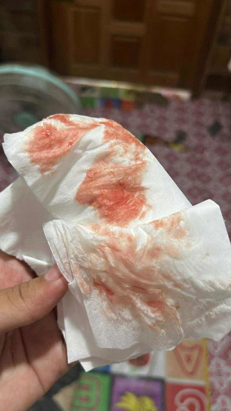 เลือดออกแบบนี้ปกติไหม