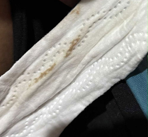 Brown Discharge