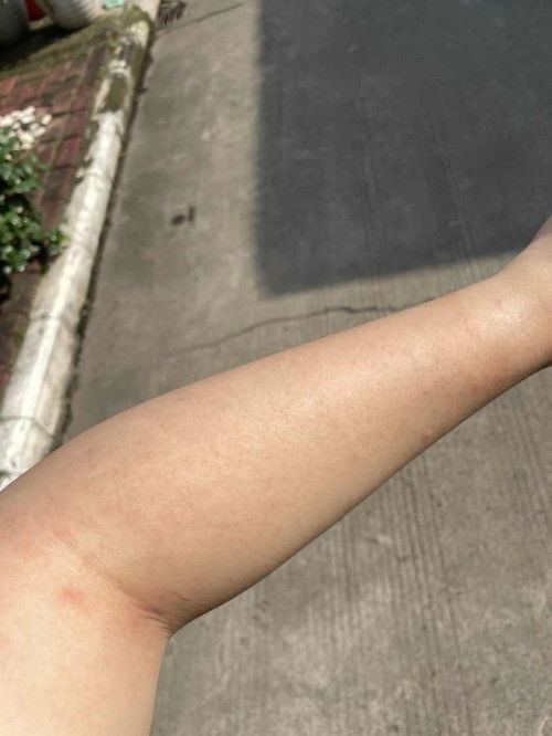 Ada gaksi yang keluar merah2 gini tbtb?